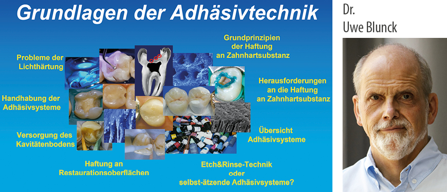 Grundlagen der Adhäsivtechnik in 8 Modulen