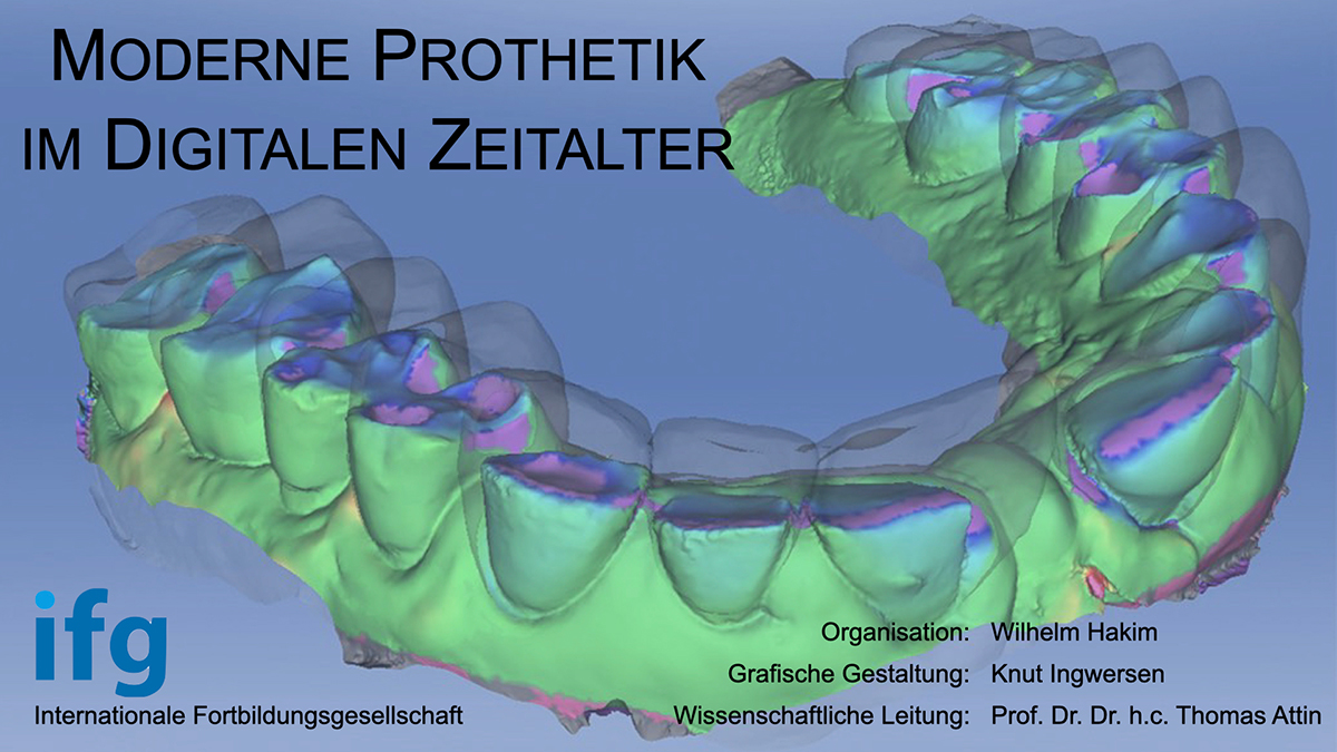 Online-Kongress: Moderne Prothetik im digitalen Zeitalter
